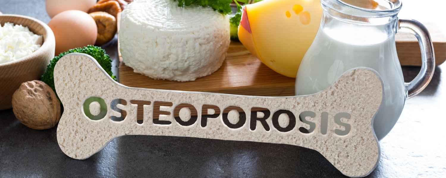 Un os factice devant un plateau de fromage, sur lequel est inscrit le mot "osteoporose"